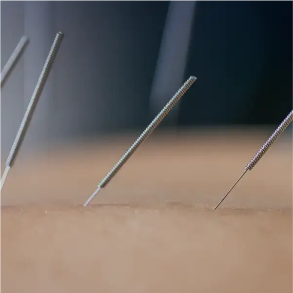 Curso de Acupuntura